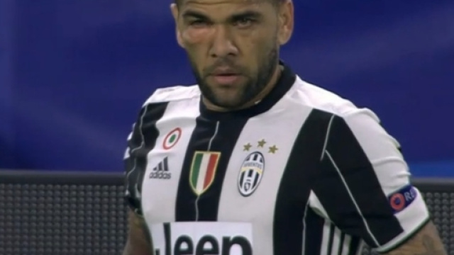 Juventus-Lione, Dani Alves come Rocky: che botta all'occhio ... - corrieredellosport.it