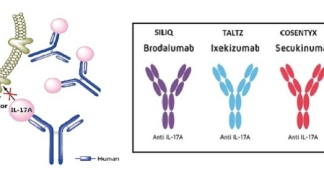 Tre anticorpi monoclonali contro l&rsquo;interleuchina 17A, per contrastare la psoriasi