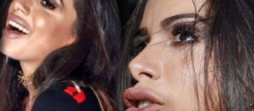 Anitta ficou com a boca muito inchada pelo botox.