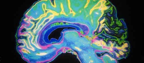 Autism brain scans - yourpaf.com