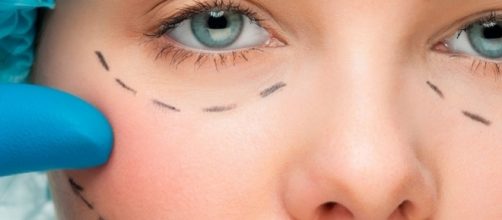 Cirurgia est&eacute;tica funcional &eacute; a nova moda para afinar o rosto