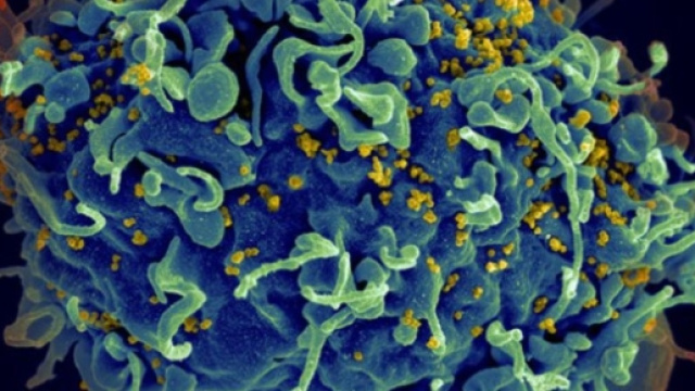 Un vaccin universel contre le VIH (sida) aurait &eacute;t&eacute; mis au point ... - science-et-vie.com