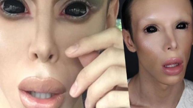 Vinny Ohh: ecco com'era l'uomo-alieno prima di farsi le 110 ... - bitchyf.it