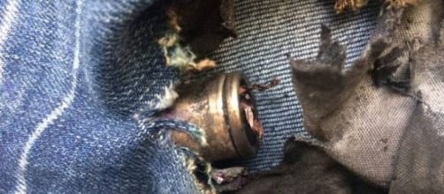 E-cigarette battery explosion image credit Global news