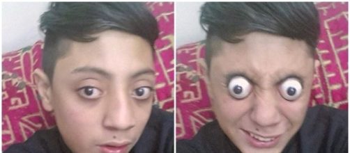 Conhe&ccedil;a o jovem que pode estourar seus olhos para fora