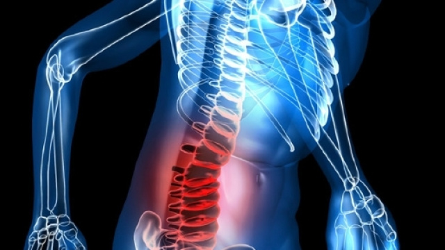 Il mal di schiena non va curato con gli antinfiammatori