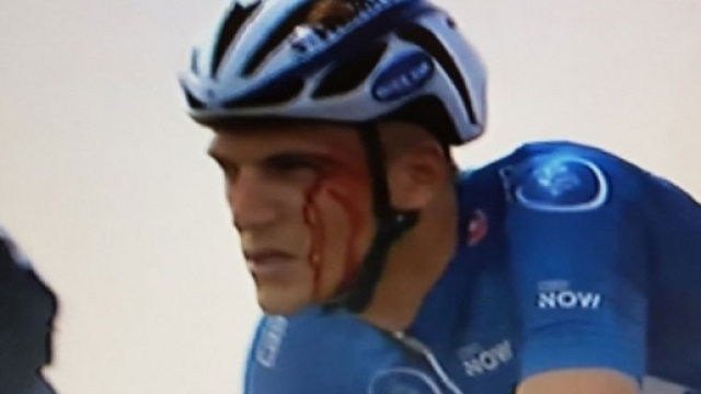 Marcel Kittel dopo il colpo subito da Grivko
