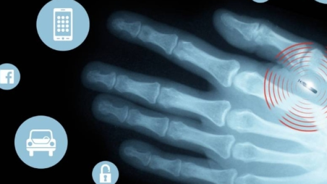 France Info : Les &laquo; Implants parties &raquo; _ Les implants NFC arrive ... - iatranshumanisme.com