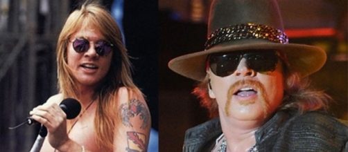 O antes e o depois de Axl Rose