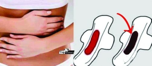 Um sangramento de colora&ccedil;&atilde;o mais escura muitas vezes preocupa a mulher.