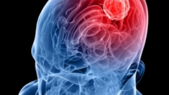 Meningite: la malattia non si arresta