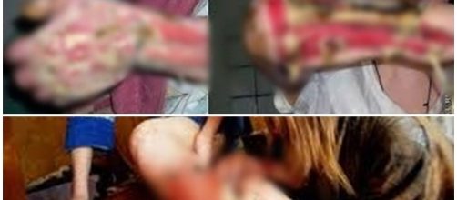 Droga causa v&aacute;rios danos f&iacute;sicos e mentais