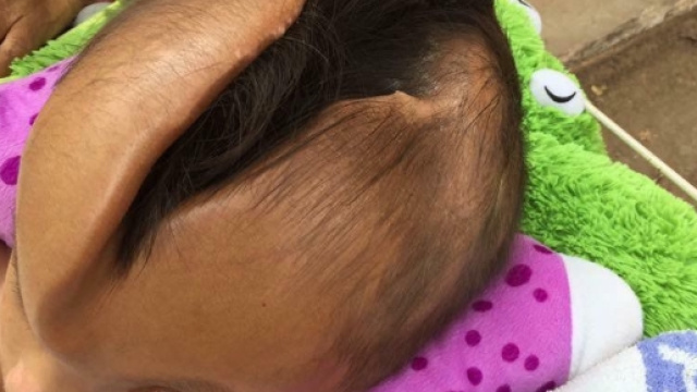 Il bimbo con una crepa in testa