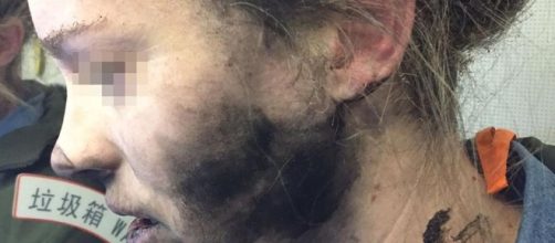 Headphone batteries explode, injures passenger on flight to ... - hindustantimes.com