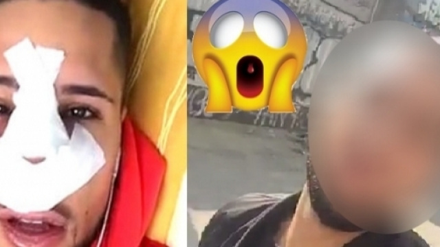 Eddy a beaucoup souffert apr&egrave;s l'op&eacute;ration