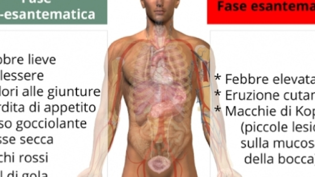 Torna il morbillo e pu&ograve; avere conseguenze letali