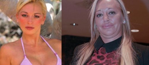 5 cambios de famosos que dan miedo, por su afici&oacute;n a la cirug&iacute;a ... - eldiario.es