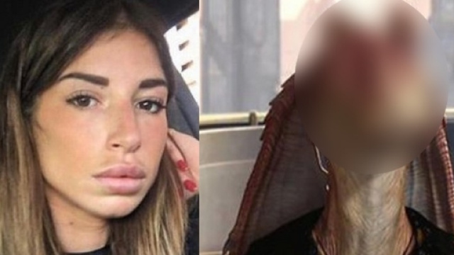 Liam la ris&eacute;e des internautes &agrave; cause de ses l&egrave;vres refaites !