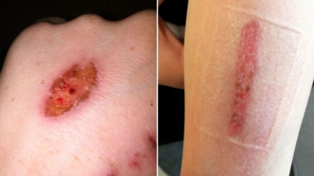 Eraser Challenge, alcune foto prova