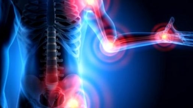 Gli esercizi di resistenza migliorano dolore, fatica e forza muscolare nei soggetti normopeso.