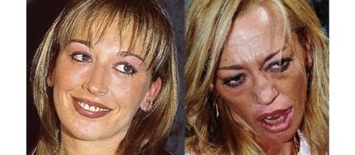 Las dos caras de Bel&eacute;n Esteban.