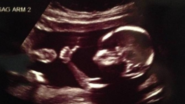 Texas, ok del Senato al disegno di legge sull'aborto