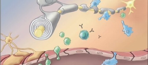 Pathophysiology of multiple sclerosis (https://www.researchgate.net)