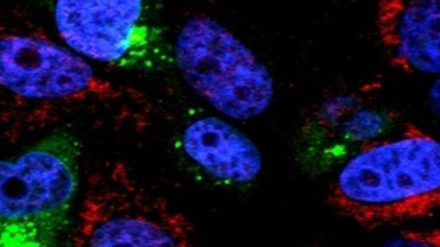 Allarme Epatite A tra gli omosessuali