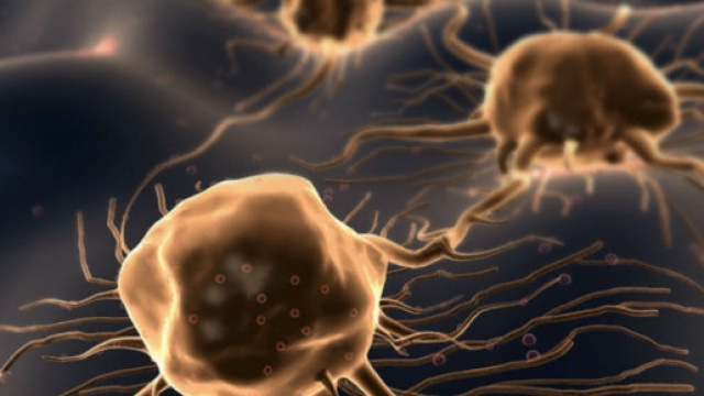 Cellule tumorali osservate al microscopio