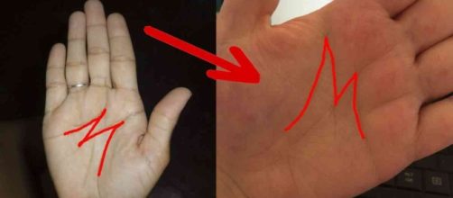 Voc&ecirc; possui a marca 'M' nas m&atilde;os? Saiba que isso &eacute; uma marcar rara