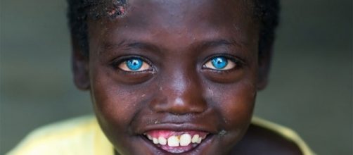 Abushe, a crian&ccedil;a africana com olhos azuis