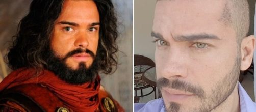 Sidney Sampaio, antes e depois: procedimento realizado com sucesso