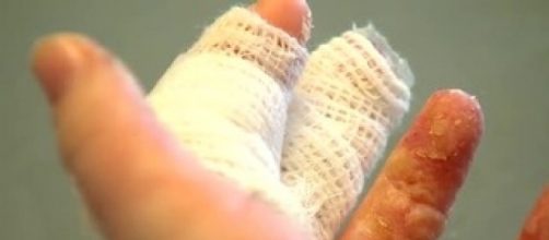 Girl making homemade slime gets burned, warns others | WJLA - wjla.com