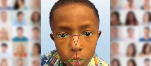 Selfies, yes selfies, could help diagnose rare genetic disease - CNET - cnet.com