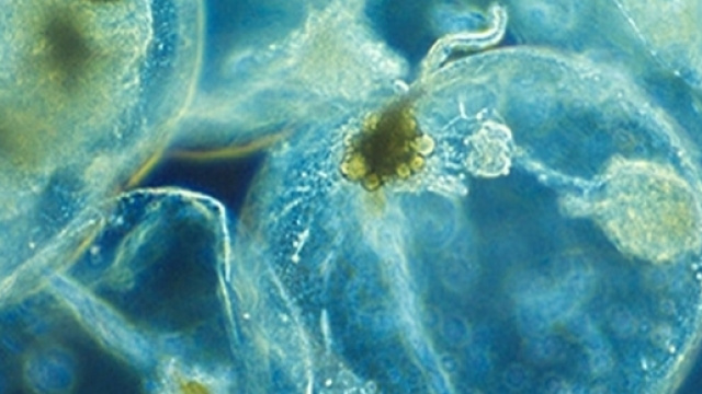 Noctiluca scintillans (Creative Commons Attribution 3.0 License)