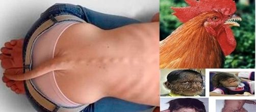 Os casos mais estranhos de Atavismo