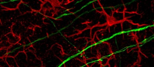 New depression diagnosis and treatment based on 'microglia' cells ... - psypost.org