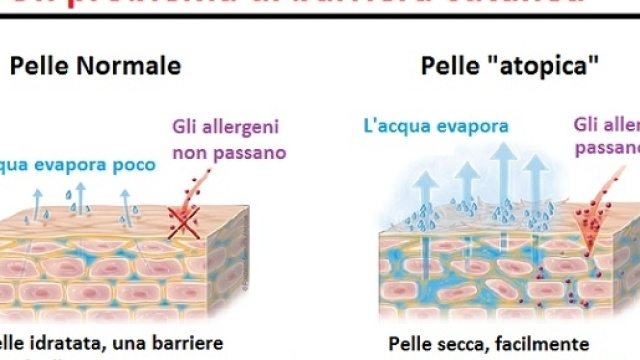 Una pelle ben idratata &egrave; la prima barriera agli attacchi dagli agenti esterni