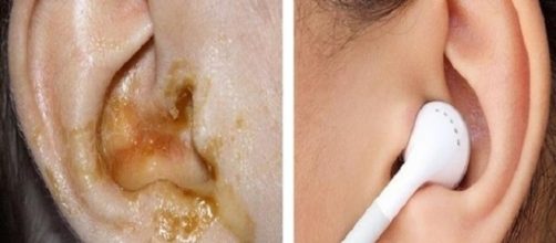 Jamais compartilhe essas 7 coisas com outra pessoa ou voc&ecirc; pode vir a ter doen&ccedil;as graves