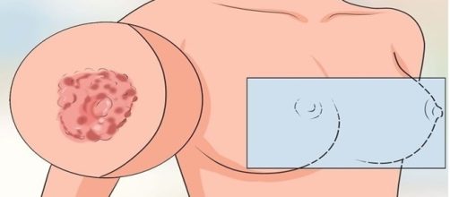 Se voc&ecirc; apresentou esses sintomas, o ideal &eacute; procurar um m&eacute;dico imediatamente