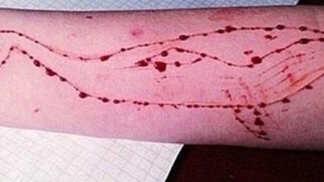 Blue Whale, il raccapricciante gioco che ha gi&agrave; portato alla morte 130 adolescenti