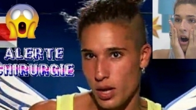 Eddy n'en est pas &agrave; sa premi&egrave;re op&eacute;ration de chirurgie esth&eacute;tique