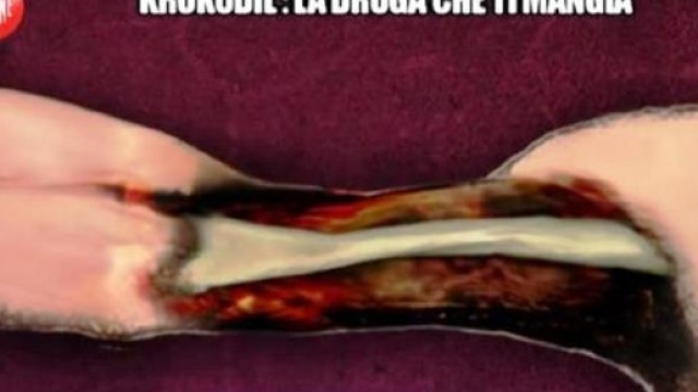 Krokodil, la droga russa che ti mangia la carne