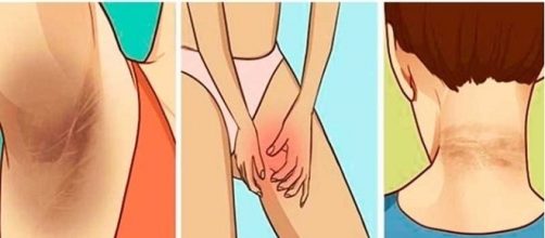 Dicas para acabar com manchas na pele