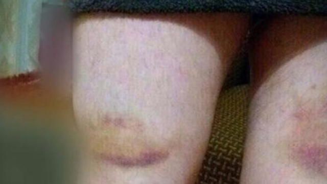 Cecenia: comunit&agrave; gay in prigione