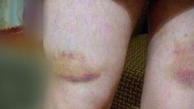 Torture su omosessuale (foto Novaya Gazeta)