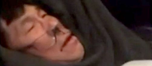 Doctor dragged off United flight needs reconstructive surgery ... - go.com