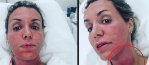 Renata Banhara ficou doente ap&oacute;s tratamento no dente