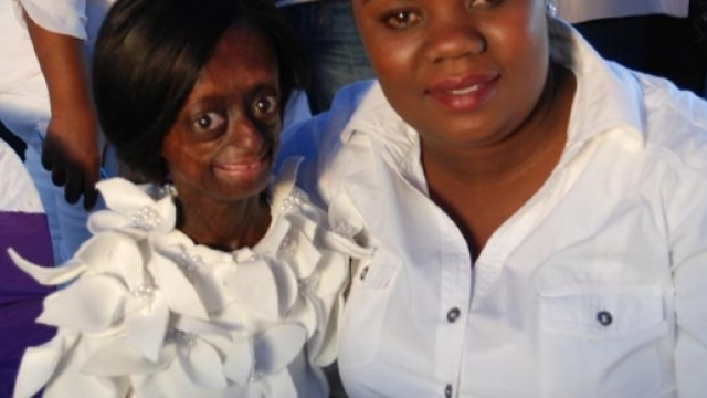 Ontlametse: una storia di vita drammatica