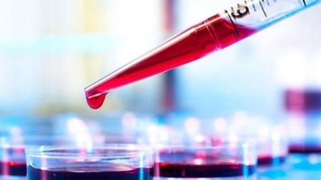 Il test del sangue per la diagnosi precoce del tumore